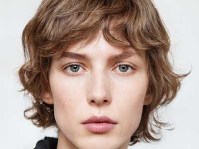 韓可旺跟劉勁文哪個醫生修復饅化臉好？韓可旺擅長分層溶解+提升，醫姿妍30例實例可查